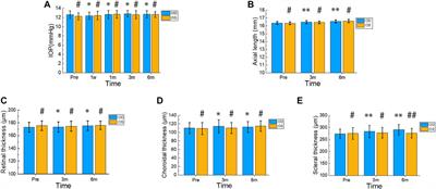 Evaluation of new robust silk fibroin hydrogels for posterior scleral reinforcement in rabbits